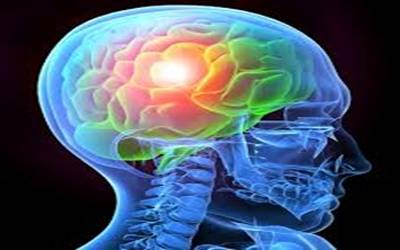 brain injury20160629184739_l